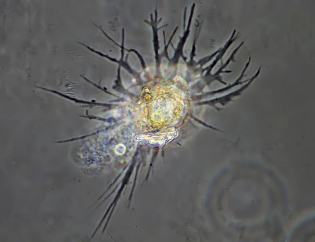 Phryganella paradoxa