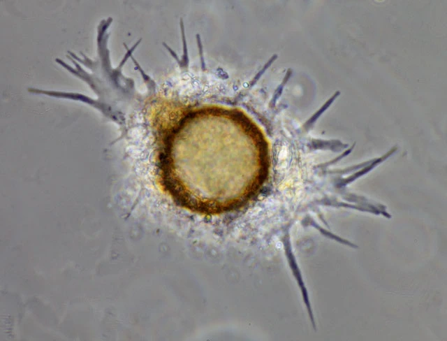 Phryganella acropodia