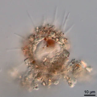 Phryganella acropodia