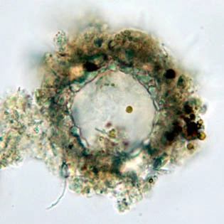 Phryganella acropodia