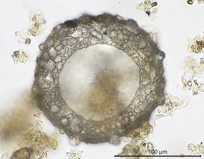 Phryganella nidulus.