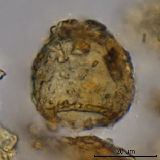 Cryptodifflugia paradoxa