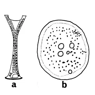 Eiffelospina bifurcata