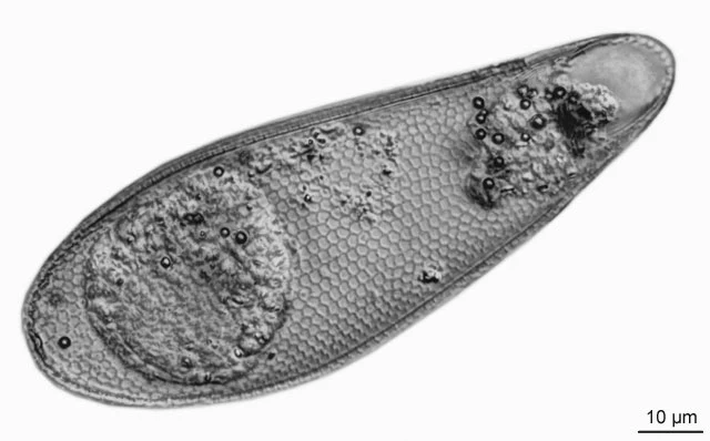 Cyphoderia ampulla