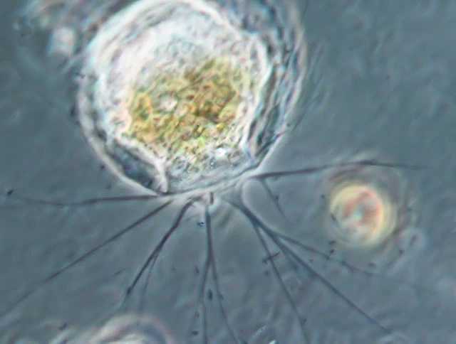 Placocista lens