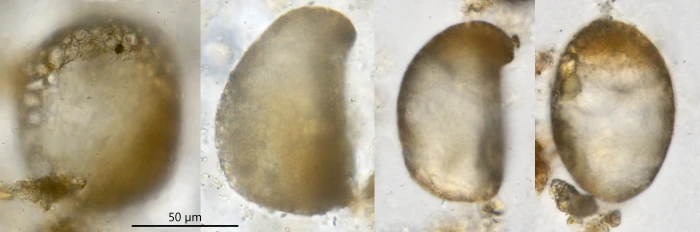 Plagiopyxis rostrata