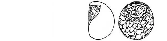 Plagiopyxis declivis cyclostoma