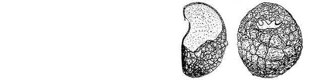 Plagiopyxis glyphostoma
