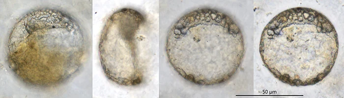 Plagiopyxis intermedia