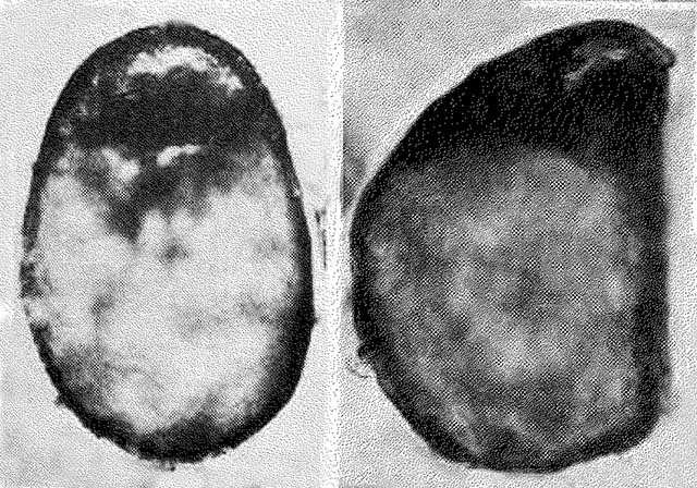 Plagiopyxis bicamera