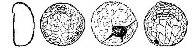 Plagiopyxis minuta