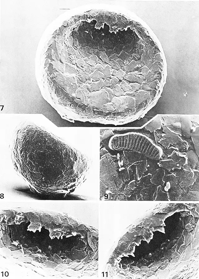 Plagiopyxis