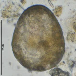 Planhoogenraadia sp