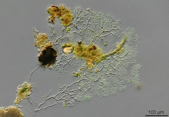 Arboramoeba reticulata
