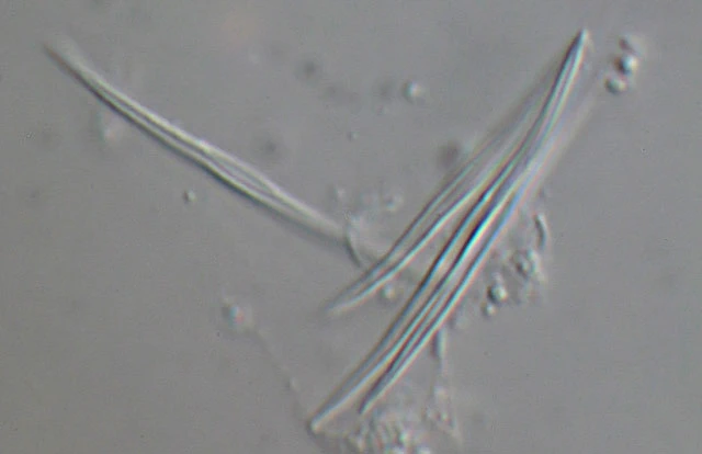 Raphidocystis pallida