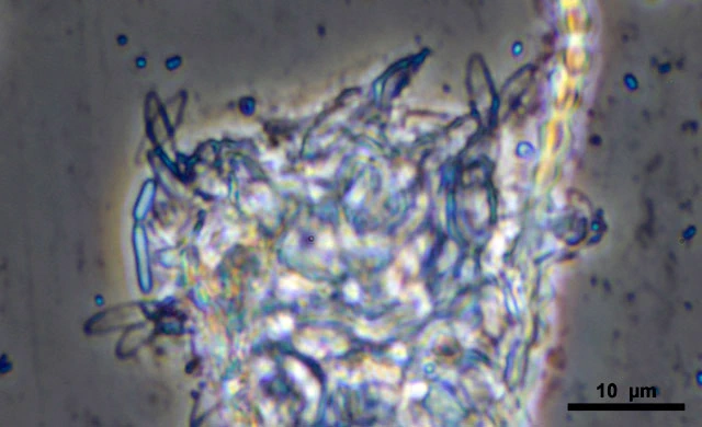 Raphidocystis symmetrica