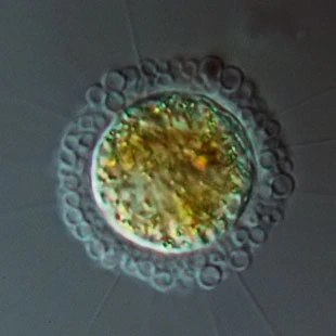 Pompholyxophrys punicea