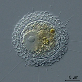 Pompholyxophrys punicea