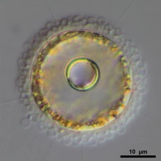 Pompholyxophrys punicea