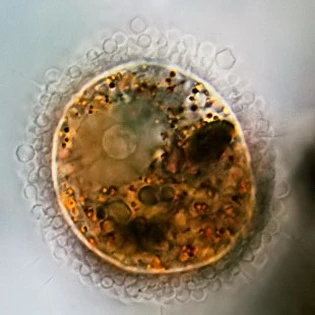 Pompholyxophrys punicea