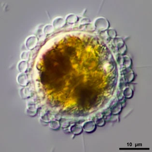 Pompholyxophrys punicea
