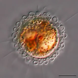 Pompholyxophrys punicea