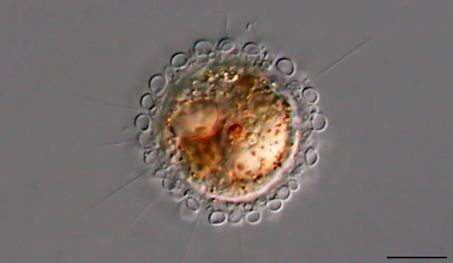 Pompholyxophrys punicea