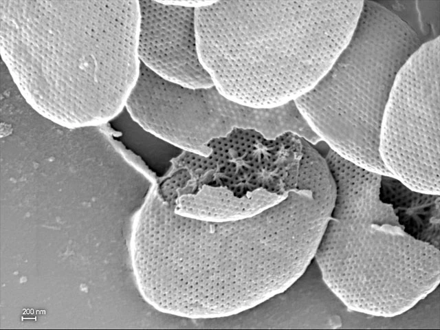 Pompholyxophrys stellata