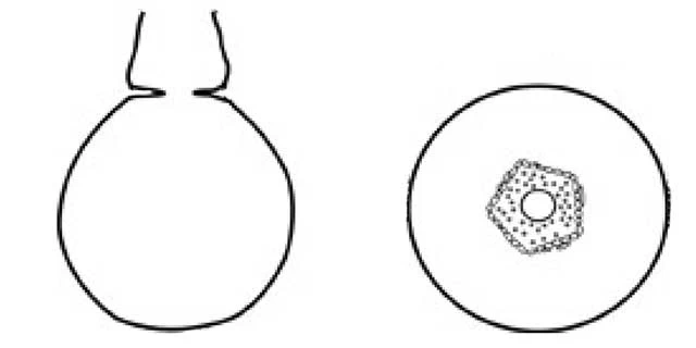 Pontigulasia pentangulostoma