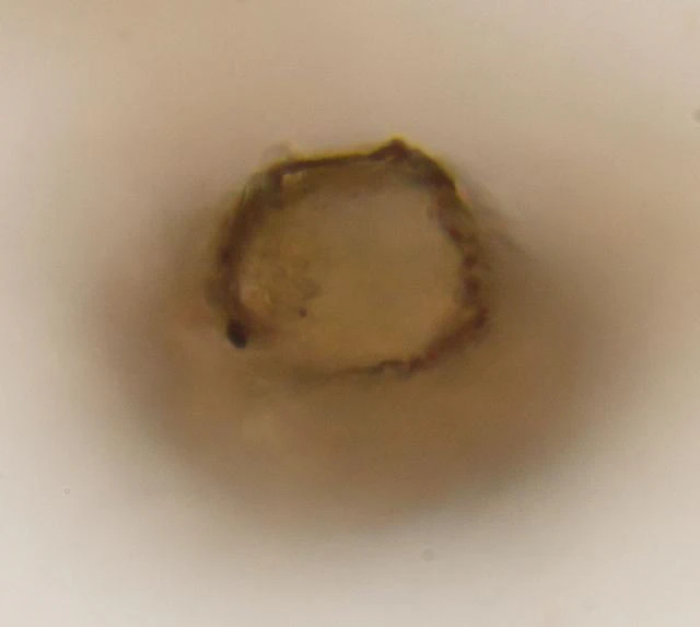 Pontigulasia rhumbleri