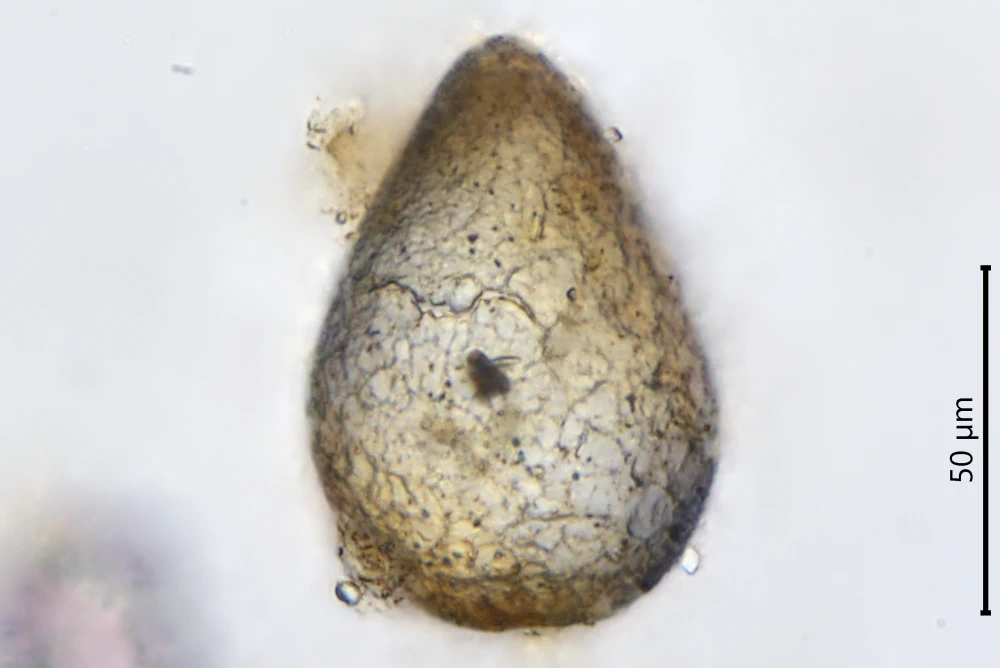 Pseudawerintzewia orbistoma