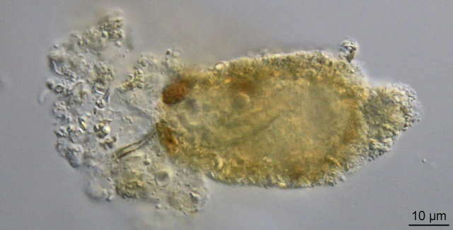 Pseudodifflugia spec.