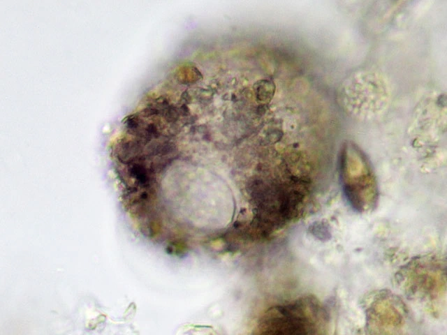 Pseudodifflugia archeri