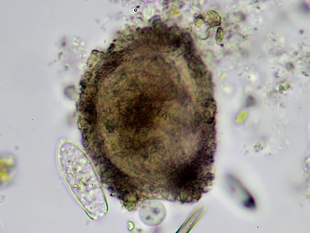 Pseudodifflugia archeri