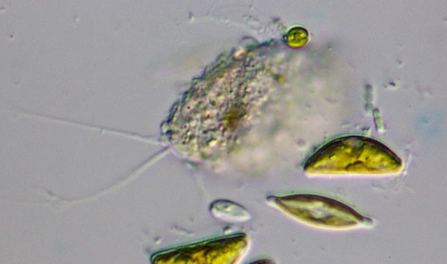 Pseudodifflugia spec.