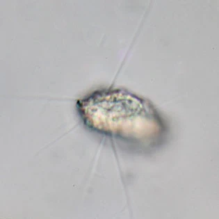 Pseudodifflugia compressa