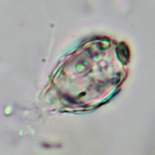 Pseudodifflugia klarae