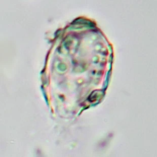 Pseudodifflugia klarae