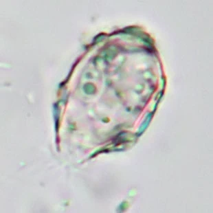 Pseudodifflugia klarae