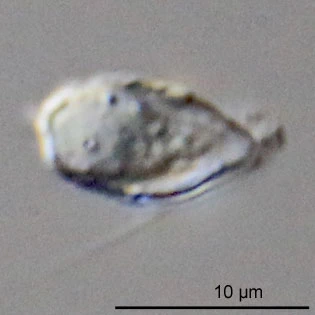 Pseudodifflugia spec.
