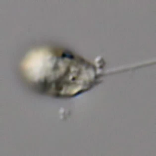 Pseudodifflugia spec.