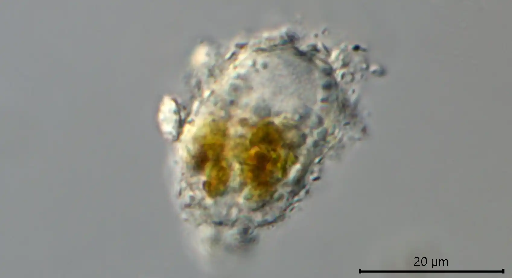 Pseudodifflugia spec.