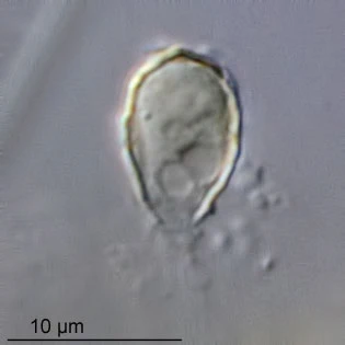 Pseudodifflugia spec.