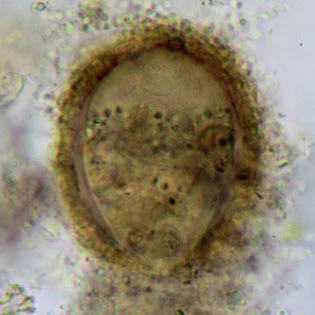 Pseudodifflugia virescens