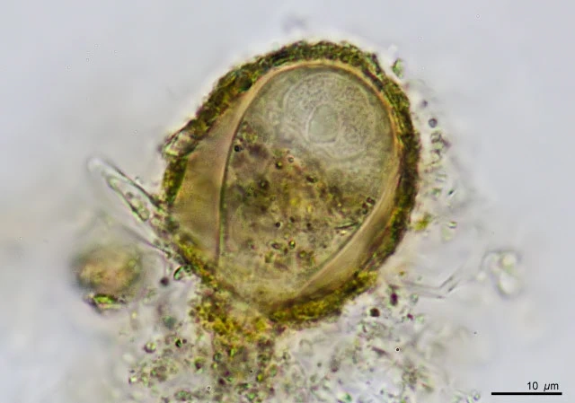 Pseudodifflugia virescens