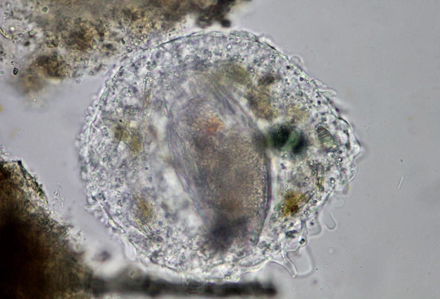 Pseudothecamoeba vesiculata