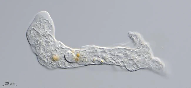 Pseudothecamoeba vesiculata
