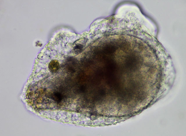 Pseudothecamoeba vesiculata