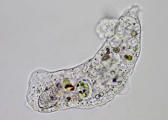 Pseudothecamoeba vesiculata
