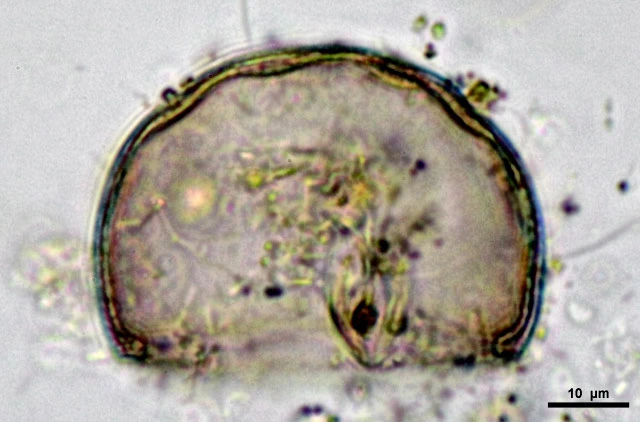 Pyxidicula patens var.